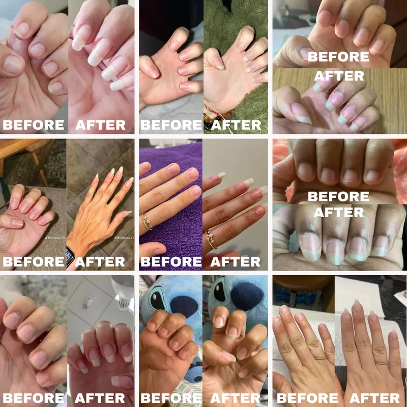 Radiant Cosmetics Nail Growth Oil - 100% Organic, Moisturizing, Growth, Strengthening, and Brightening Formula with Vitamins and Fatty Acids for Overall Nail Health 1