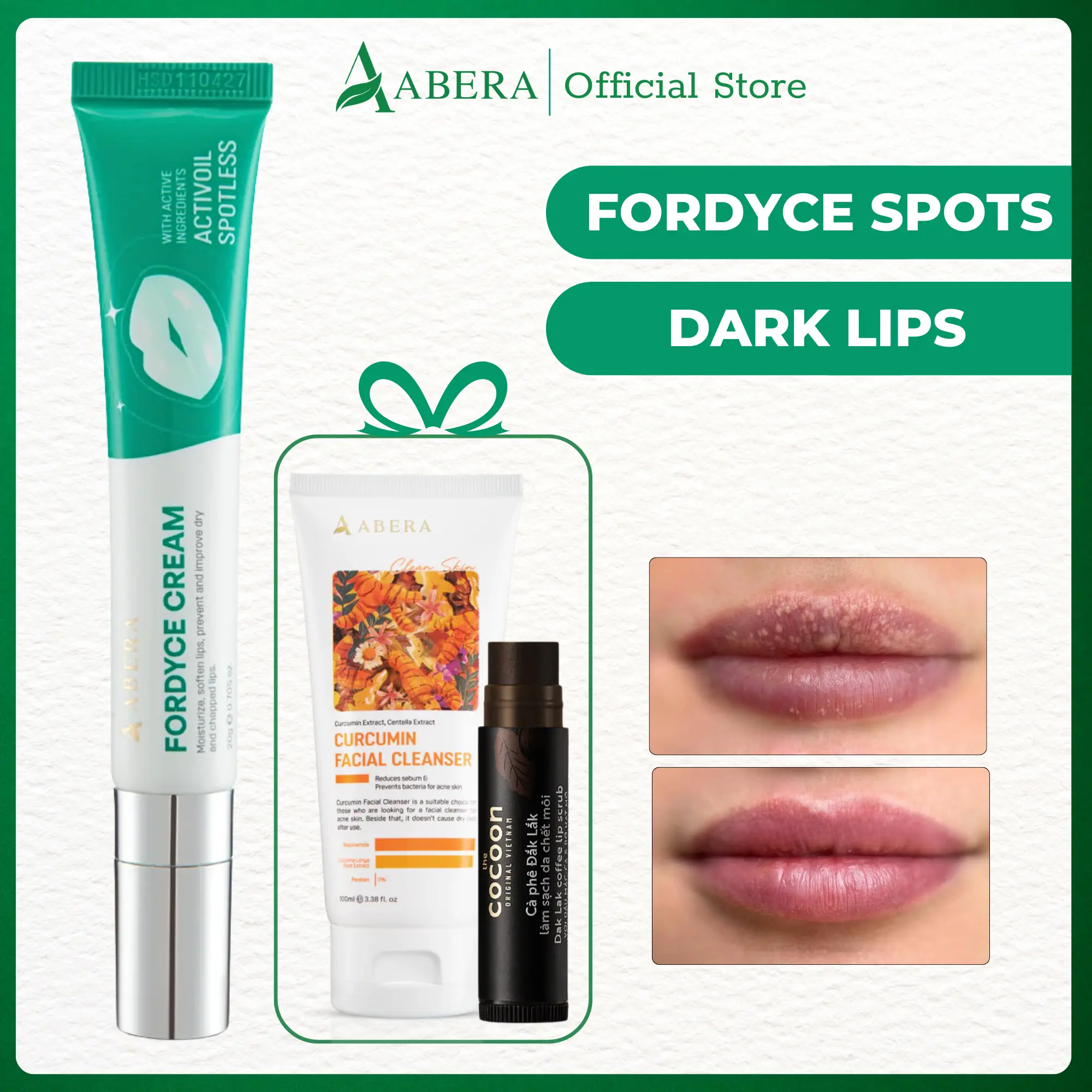 Abera Fordyce Cream - Reduce Fordyce Spot for Lips, All-day Moisturizing, Help Improve Dry, Chapped and Dark Lips (0.7 Oz)