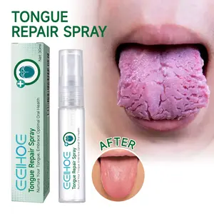 Tongue Repair Spray - Heal White Coating & Dry Cracks - Soothe Swelling & Oral Discomfort - Daily Mouth Care - 30ml Bottle