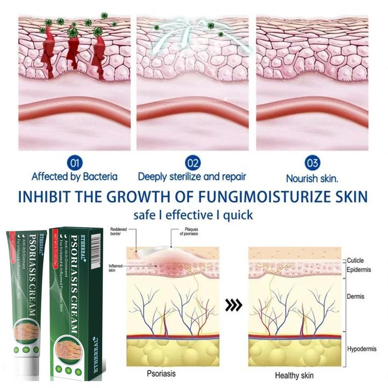 Cream for Eczema & Psoriasis,All-Natural Soothing Cream  – Best Gift,Herbal Relief for Dry, Itchy, Sensitive Skin , Anti-Bacterial Skin Defense (Hydrating, Safe for All Ages | 20g) Treatment