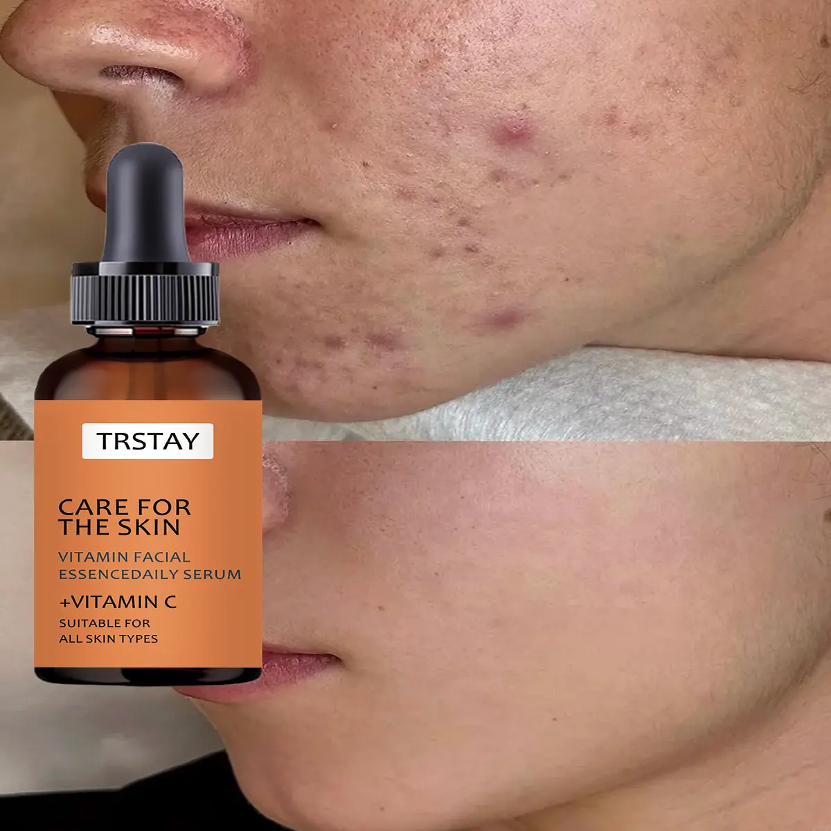 Facial Moisturizing Serum—Enriched with Vitamin C; leaves skin feeling soft and smooth, prevents dryness, and is suitable for daily facial skincare. Hydrator Serum