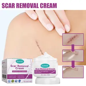 3 Pack Scar Removal Cream Advanced Scar Gel for Face Body Legs Smooth Firm Fade Acne Surgery Stretch Marks Gentle 50g Each