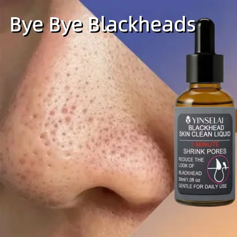 Blackhead Remover Essence, Tighten Pores, Deep Exfoliation, Remove Blackheads and Whiteheads, Suitable for All Light Skin Tones, Oil Control, Hydrating, Blackhead Remover Serum