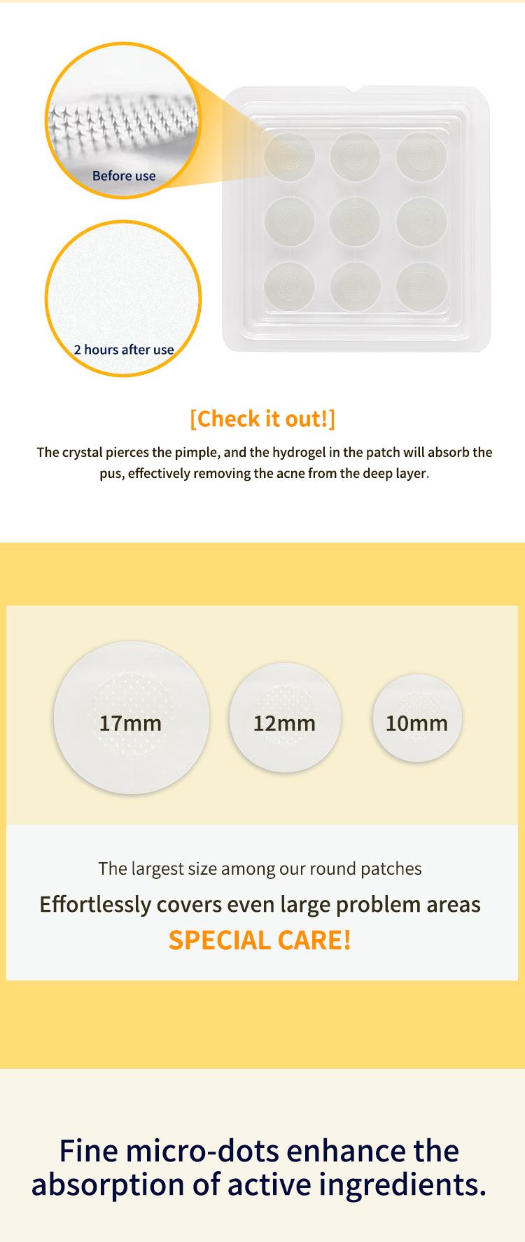 Soluble Microcrystalline Pimple Patch with Hyaluronic Acid | Deep Penetration, Skin Repair & Blemish Care