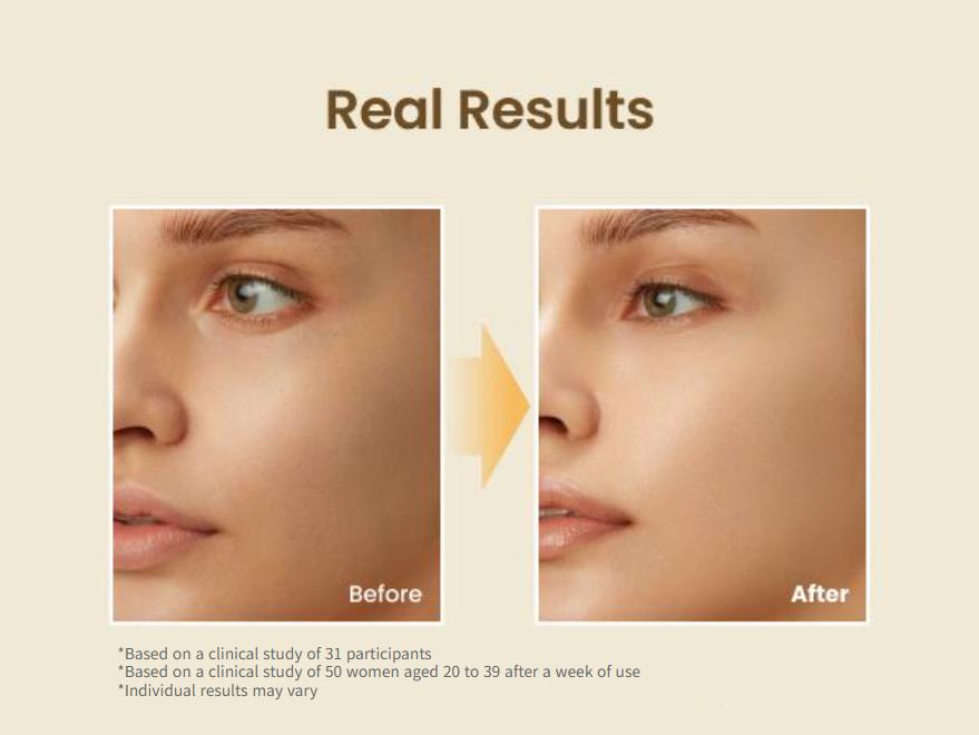 BEST Trio Exclusive Set (Propolis Energy Serum + Toner + Honey Lip Butter), 12hrs Long-lasting Hydrating & Soothing with Manuka Honey, Hyaluronic Acid, Non-Sticky Glow for Sensitive Skin, Glass Skin, Korean Skincare, Lip Plumper & Balm