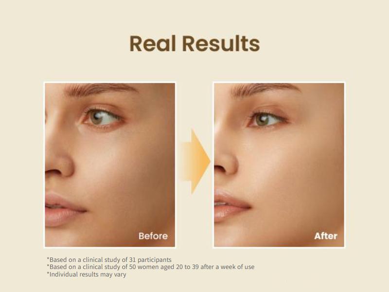 BEST Trio Exclusive Set (Propolis Energy Serum + Toner + Honey Lip Butter), 12hrs Long-lasting Hydrating & Soothing with Manuka Honey, Hyaluronic Acid, Non-Sticky Glow for Sensitive Skin, Glass Skin, Korean Skincare, Lip Plumper & Balm