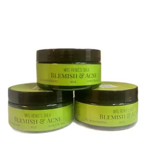 Mrs. Renee’s Shea: Blemish & Eczema 8 oz Whipped Butter with Long-Lasting Scent, Gluten-Free, Paraben-Free, and Preservative-Free for Sensitive Skin