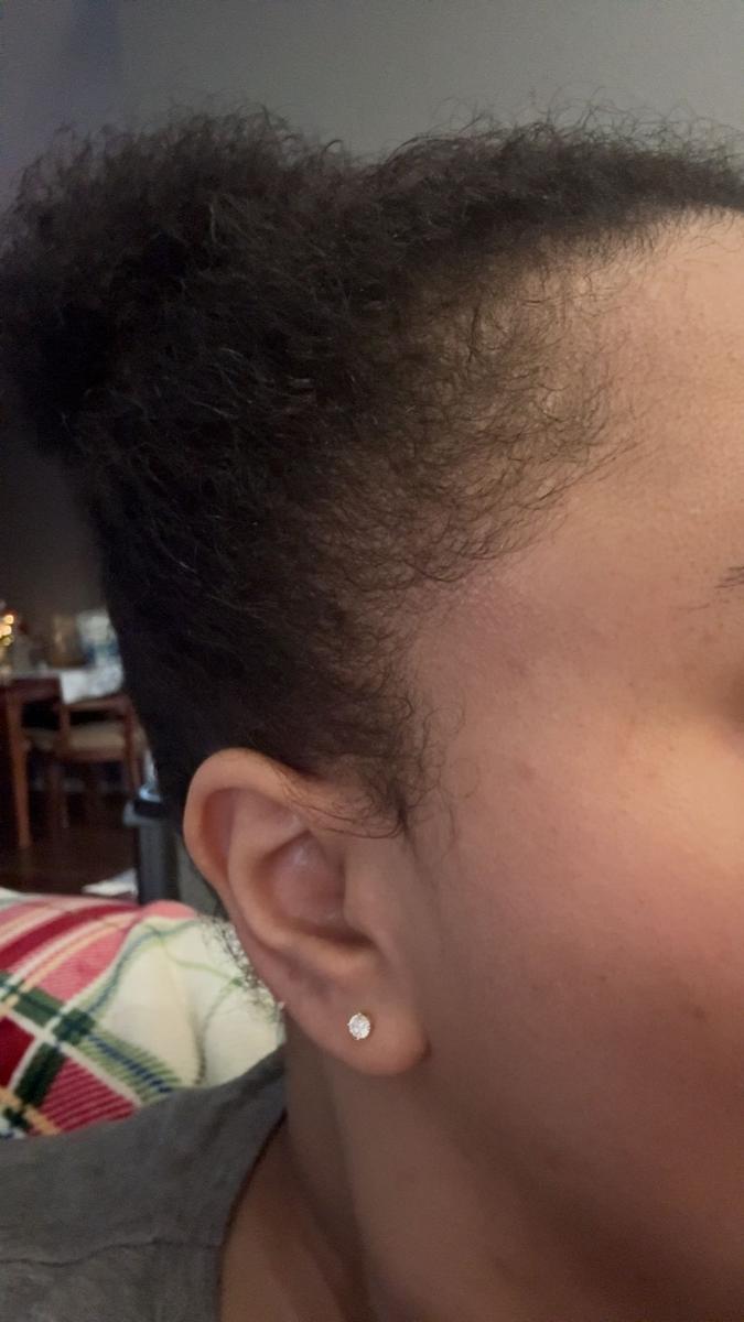 Item: Scalp Stimulator - 2oz