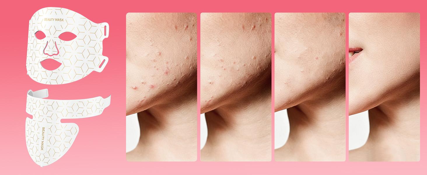 AYYHG Led Red Light Therapy Face & Neck Mask, 7  Led Light Therapy Facial Mask, Infrared Red Light Therapy Mask, Infrared Light Skin Rejuvenation(White)