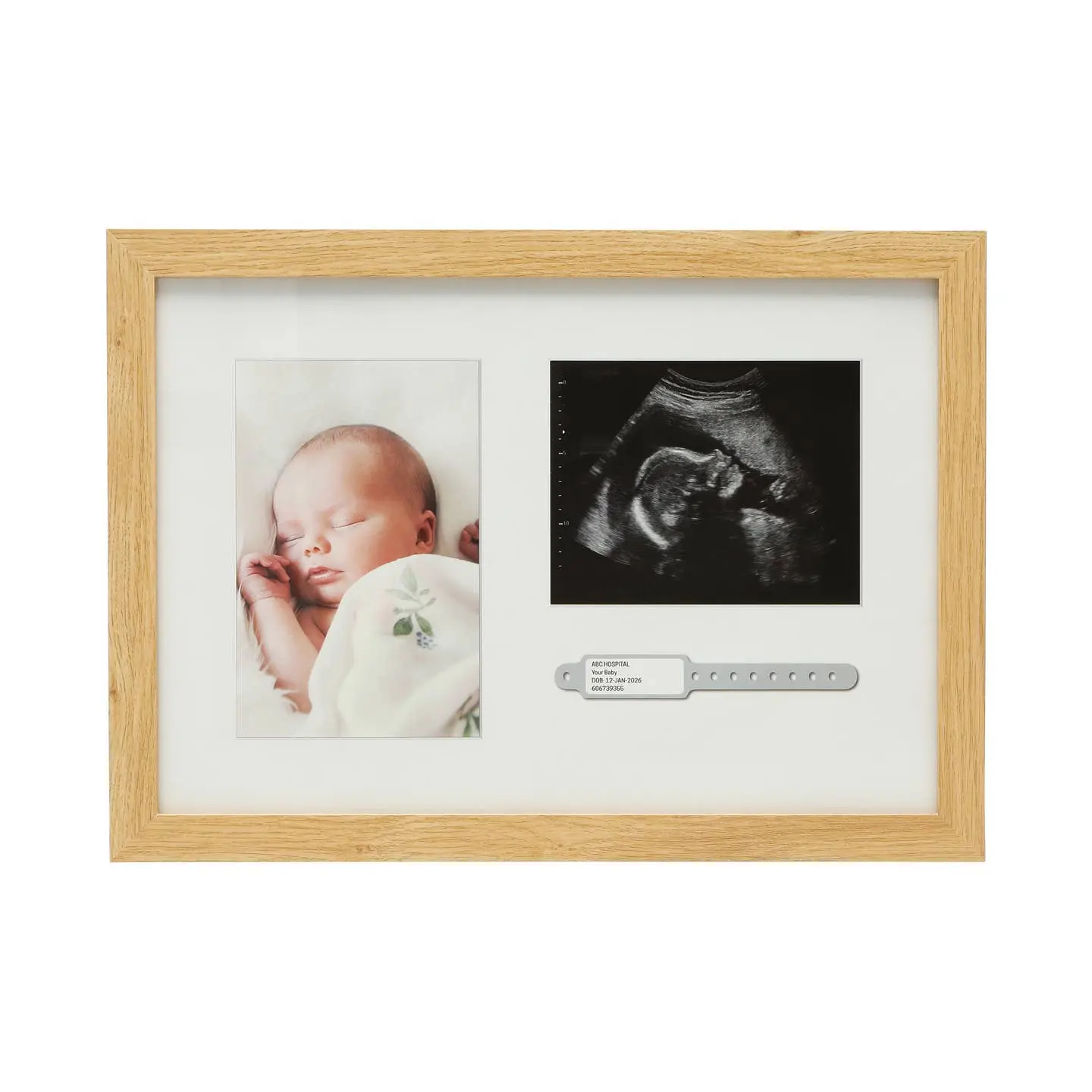 Hospital Id Bracelet, Photo & Sonogram Frame