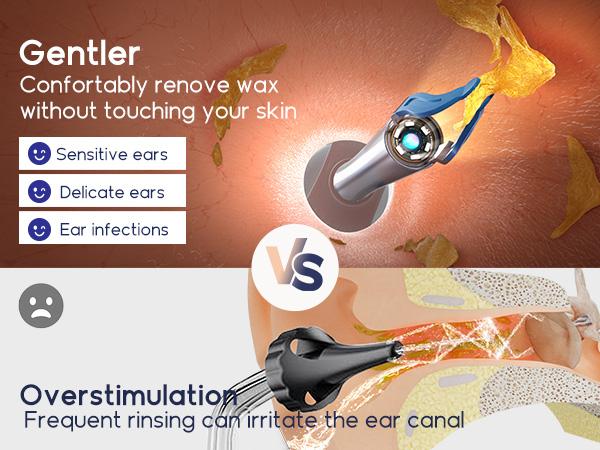 Ear Wax Removal Tool Camera, Flexible Wireless Ear Cleaner with Camera Otoscope Light, HD Painless Visual Ear Picker Tweezers Earwax Remover, Portable Safe Ear Cleaning Kit for Adults & Kids