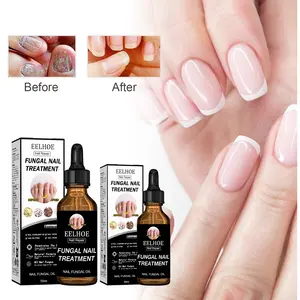 Nail repair liquid, hand and foot nail repair moisturizing nail nutrition care liquid