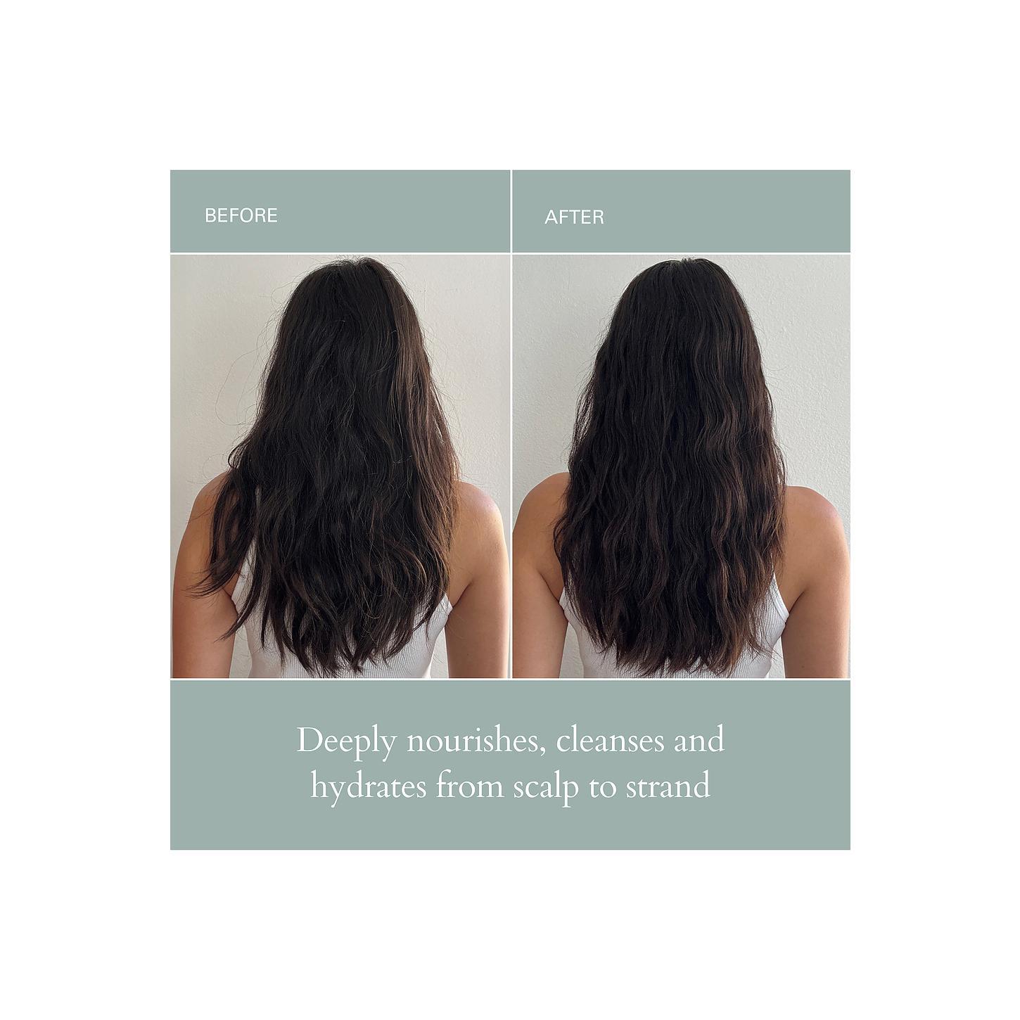 Roz Hair RŌZ Hair Healthy Hair And Scalp Kit Roz Hair RŌZ Hair Healthy Hair And Scalp Kit