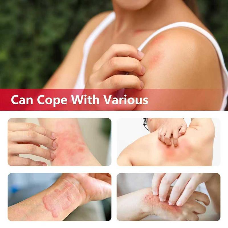 Herbal Body Care Cream - Relieves Dry and Tight Skin, Soothing Skin | Relieves Itching, Rich in Menthol, Calendula & Dendrobium for Eczema & Psoriasis (Hydrating, Safe for All Ages | 30g) Gentle Daily Calming Smooth Moisturizers Sensitive