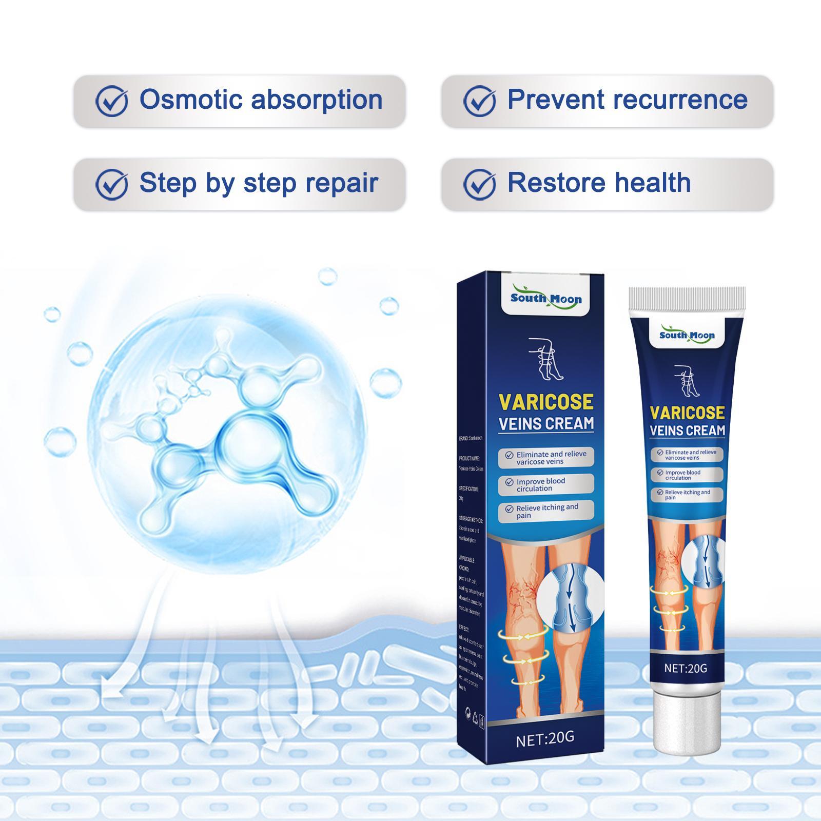 Vein Massage Varicose Cream Repair Earthworm Legs To Relieve Leg Blood Vessel Bulge And Varicoidea