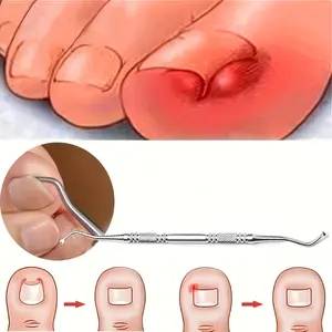 Stainless Steel Ingrown Toenail Tool, Toenail File And Lifters, Professional Surgical Safe Nail Treatment Pedicure Tool Kit Nail Cleaner Tools Pain Relief