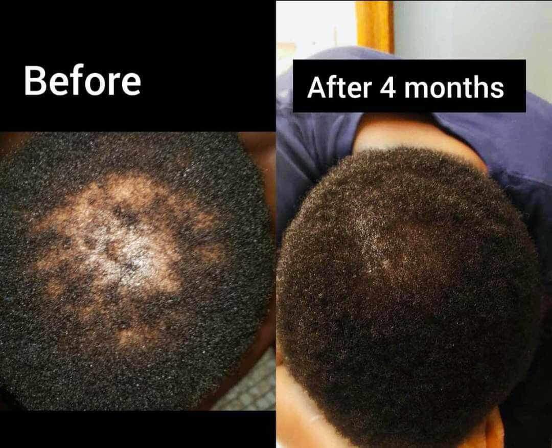 Kan's Beauty Organic Hair Growth Butter for All Hair Types - Prevents Dandruff, Hair Fall, and Itchy Scalp