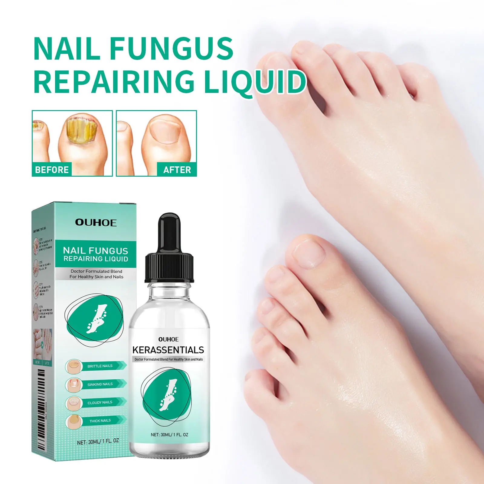 OUHOE Kerassentials Nail Fungus Repairing Liquid - Gentle Moisturizing Solution for Manicure & Nail Care - 30ml Daily Moisturizer for Repairing & Normalizing Nails nailgrowthoil