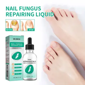 OUHOE Kerassentials Nail Fungus Repairing Liquid - Gentle Moisturizing Solution for Manicure & Nail Care - 30ml Daily Moisturizer for Repairing & Normalizing Nails nailgrowthoil