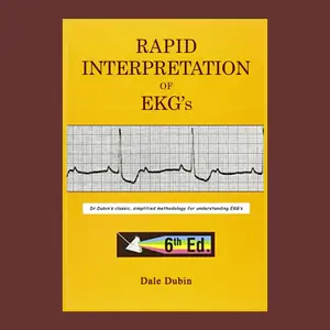 Rapid Interpretation of EKG's, Sixth Edition: A Visual and Interactive Guide by Dale Dubin for Students and Medical Professionals.