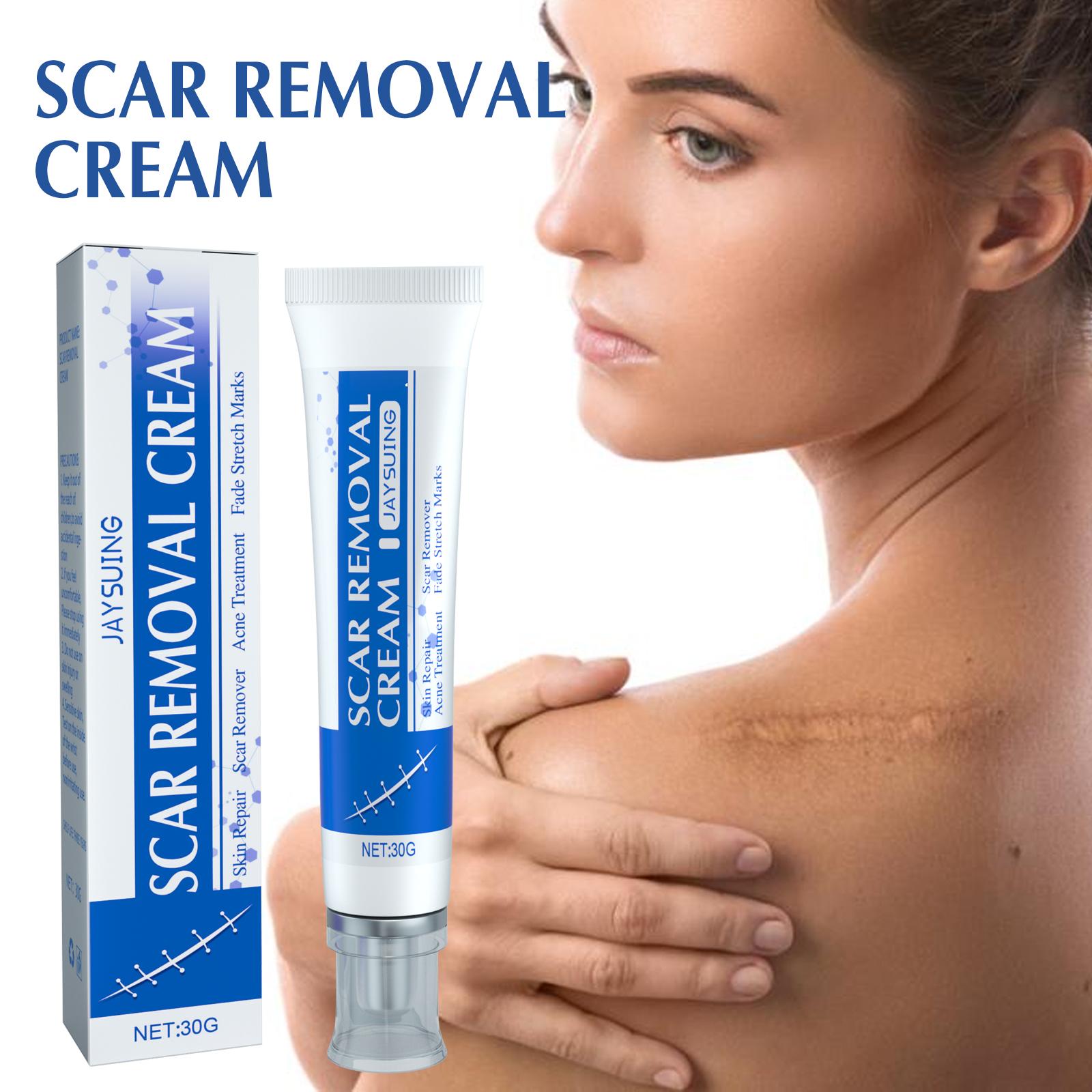 Jaysuing Skin Care Cream Daily Gentle Moisturizing Smooth Body Skin Delicate Refreshing Care Cream