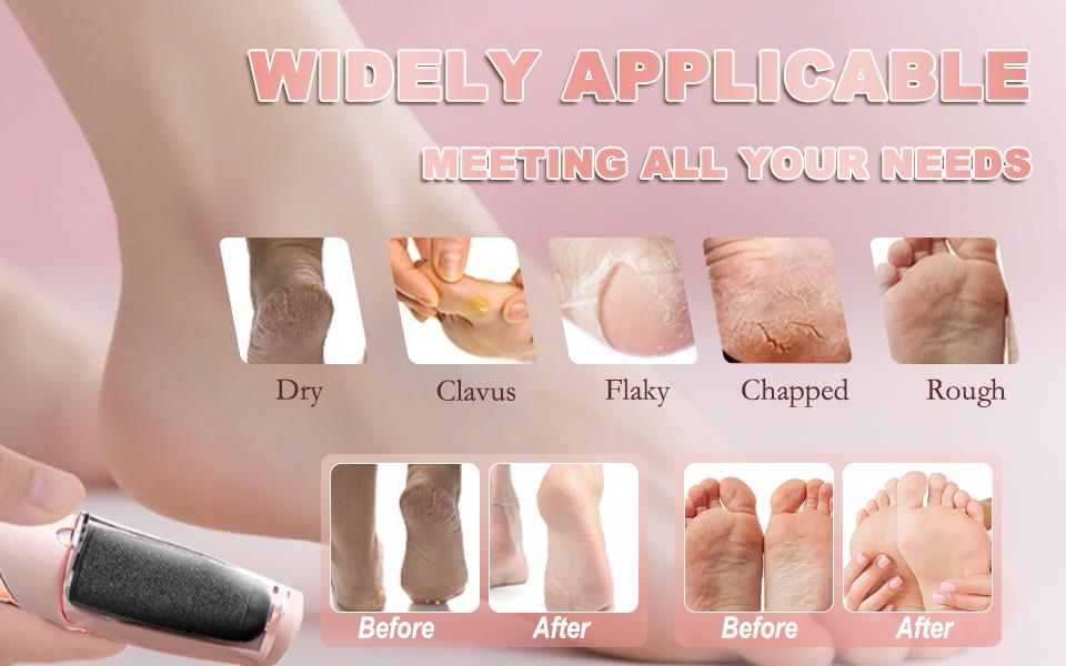 LQT Electric Foot File – Rechargeable Callus Remover for Hard, Cracked Skin – At-Home Pedicure Kit for Smooth Feet (Men & Women) (Pink) Manicure Manicure Nail Nail Care Cutics Nail Art