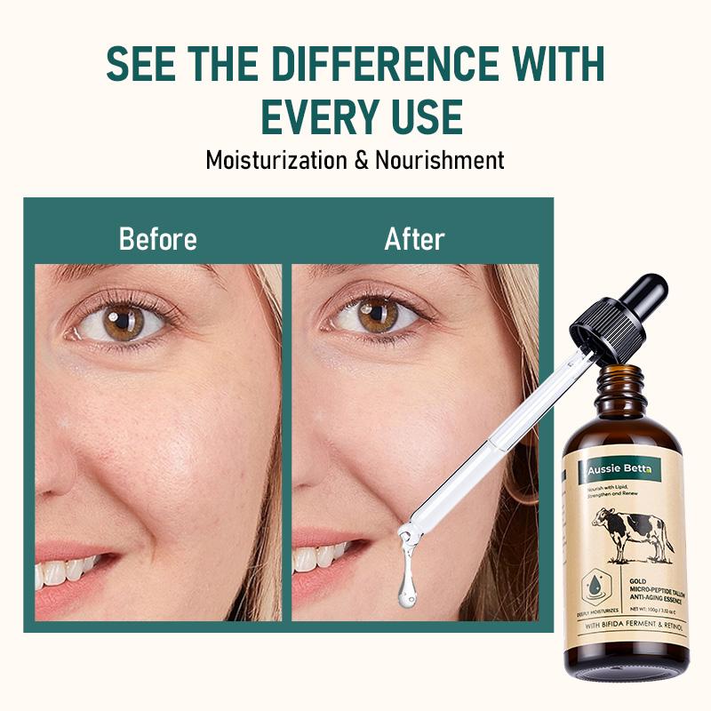 Aussie Betta Australian Pure Beef Tallow Golden Micro Peptide Serum with Niacinamide and Bifida Skin Repair Formula for Fine Lines and Dark Spots No Irritation Visible Results Anti Aging Firming Deep Hydratio