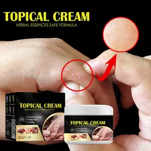 Herbal Soothing Cream for Dyshidrotic Eczema-Prone Skin – Hydrating Calming Moisturizer for Dry, Itchy, Sensitive Skin with Botanical Extracts (30g)