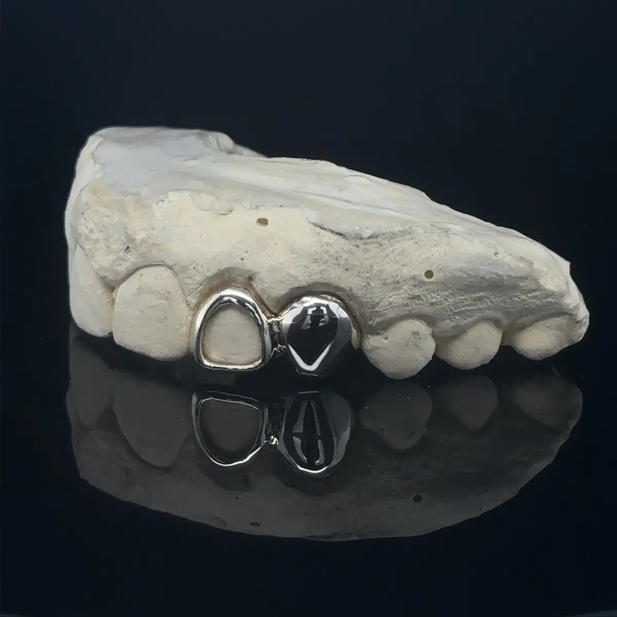 Classic 1 Open + 1 Solid Grillz