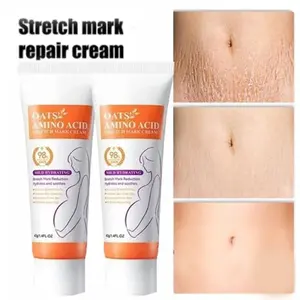 HOT SALE Stretch Marks Permanent Removal Eliminate Body Belly Stretch Marks Swelling Marks Remove Skin Cracks Repair Firming Car