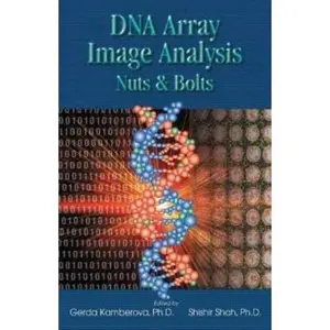 USED-DNA Array Image Analysis: Nuts and Bolts by Kamberova, Gerda, Ed. (Paperback)