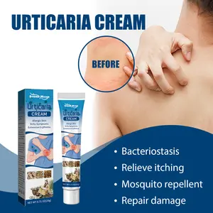 South Moon Urticaria Cream, Topical Ointment For Relieving Pruritus Redness And Repairing Skin