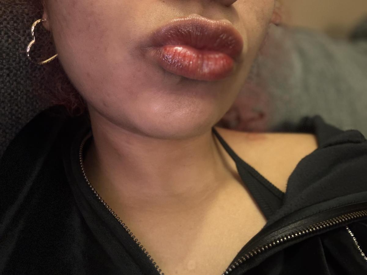 Item: #07 Cherry Fizz