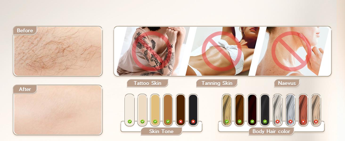 【CLEARANCE SALE】At-Home IPL Hair Removal Device, Permanent Laser Hair Removal Device for Body,Face,Bikini Line,Legs,Armpit,Unlimited Flashes, FDA Cleared IPL device, Comfort,Smoothness,Portable.