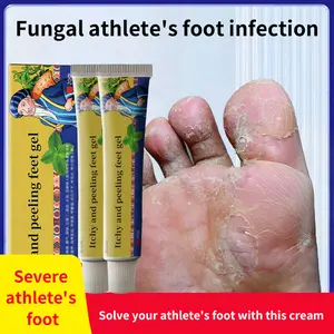 Athlete's Foot Ointment: For cracked feet, itchy feet, foot odor, sweaty feet, blisters, peeling, chapping, erosive skin and itching relief.
