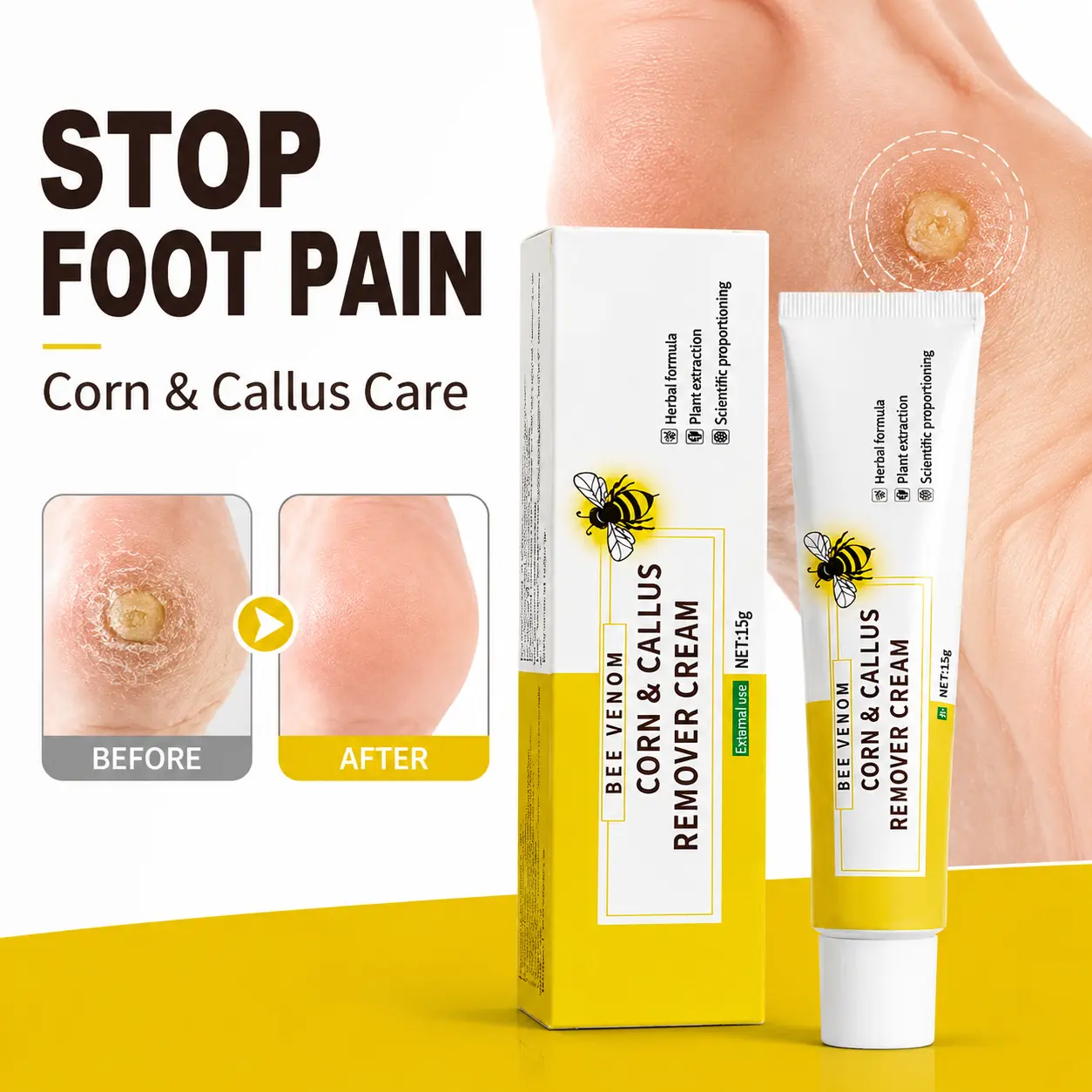 Bee Venom Foot Care Cream | Daily Care for Dry Heels, Rough Skin & Hard Areas | Lightweight & Fast-Absorbing Formula