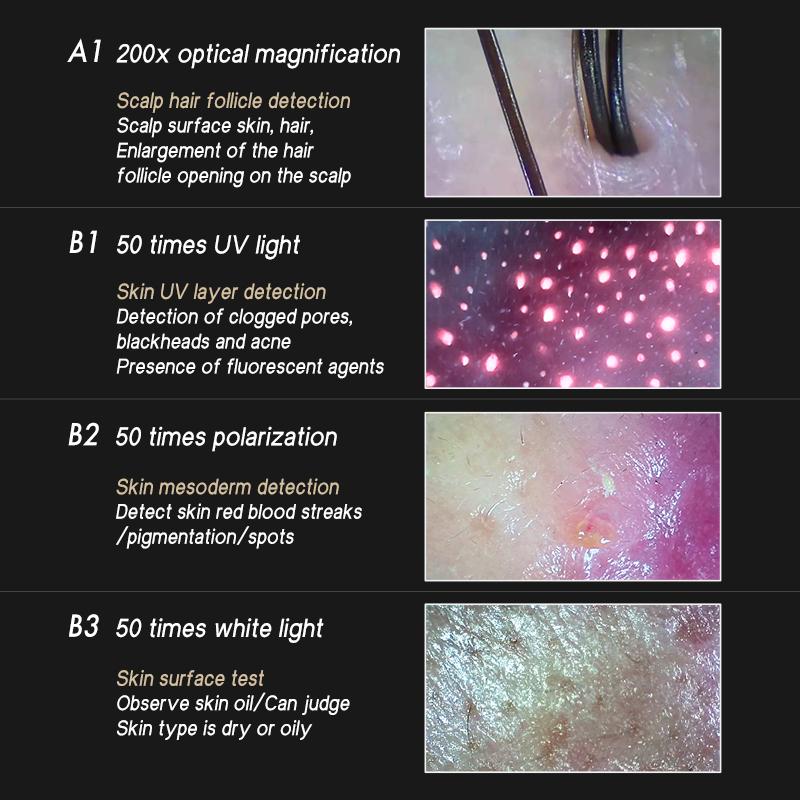 Meiboyi Classic HD Home Use Skin Analyzer Dual Lens 200X 50X Scalp Camera Skin Analysis Device Scalp Scanner Skin Detector