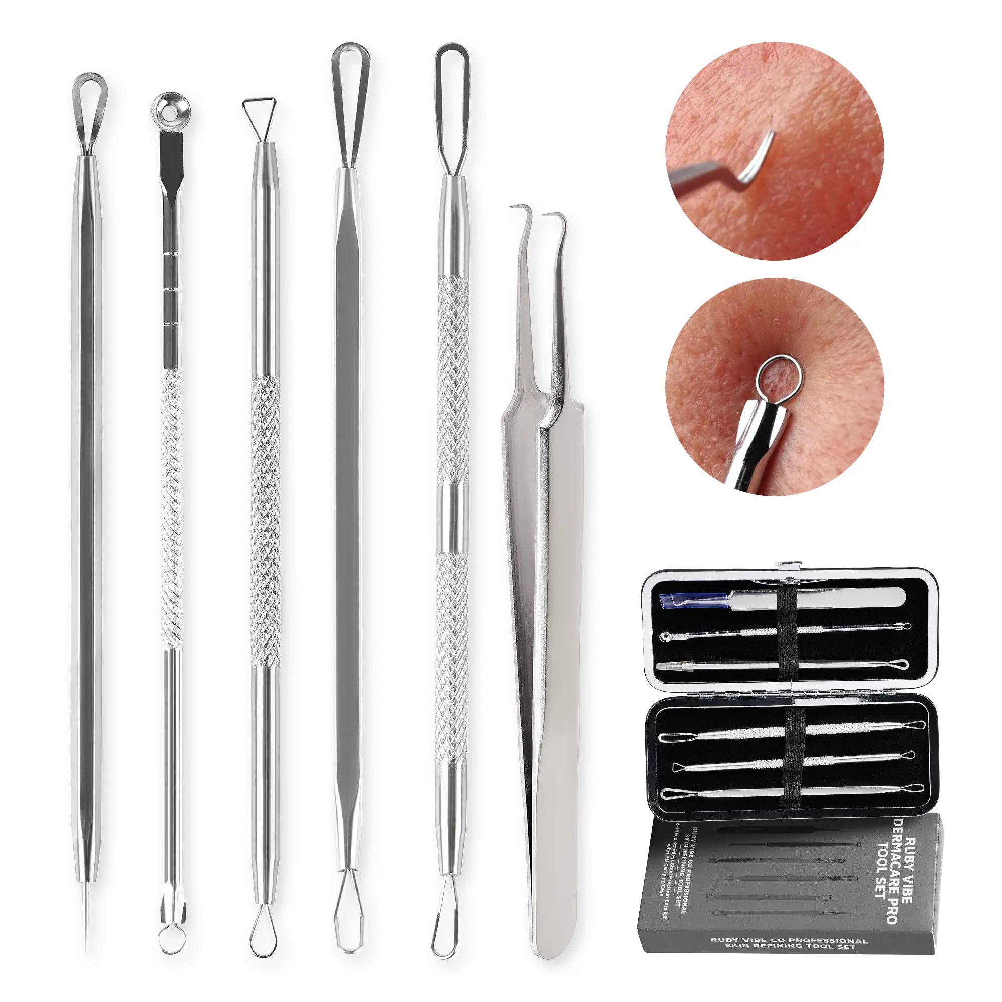 [RUBY VIBE CO] DermaCare Pro Tool Set, 6-Pieces Professional Blackhead Removal Tool Kit, Stainless Steel Acne Extractor Set with PU Carrying Case, Pimple Comedone Extraction At Home