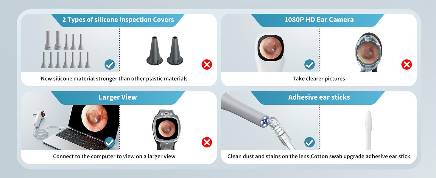 Otoscope Ear Camera with 1.21” Screen, 1080P Ear Scope with 4 LED Lights, Otoscope Camera for Adults Kids and Pets, Support Photo & Video, Type-C Charging with Computers, Baby Essentials, Home Medical