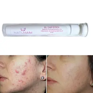 BPO Zap stick BLEMISH CONTROL - Natuhaim skin care