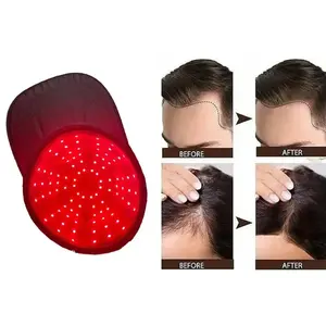 Light Therapy Hair Growth Cap, LED Near Infrared Anti-Hair Loss Device, Relaxing Head Treatment Machine, Model Lhm-003