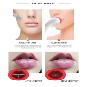 Automatic Silicone Lip Plumper Device  Fuller-looking lips. No needles. No chemicals. Just results. tiktokshopspringglowup