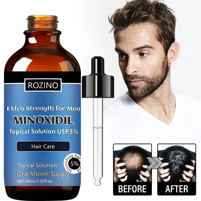 5% Minoxidil Hair Strengthening Solution, Hair Strengthening Serum, Hair Care Product for Men, Strengthens Hair, Hair Products, Hair Growth Formula, Hair Growth Accelerator, Hair Growth Stimulator, Hair Growth Booster