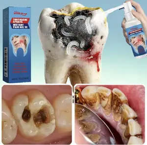 South Moon Oral Care Spray Tooth Care Soothing Tooth Discomfort Gentle Oral Care Spray B Instant Natural Whitening Paint enamel protector