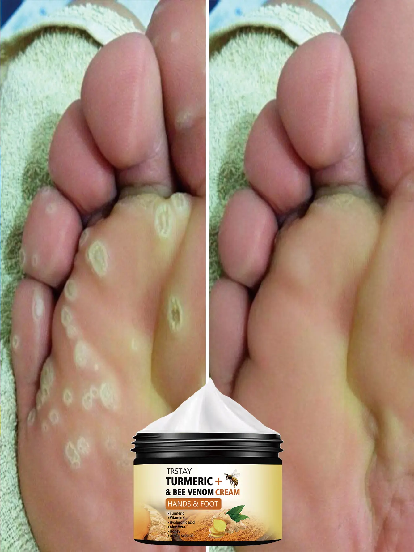 Nourishing Foot Cream for Dry Feet, Post-Cleansing Foot Moisturizer with Glycerin, Hyaluronic Acid & Argan Oil, Soft Smooth Heel Care   , Hydrate Restore Daily Moisture Hydrating Nails, Vitamin C, Moisturizing