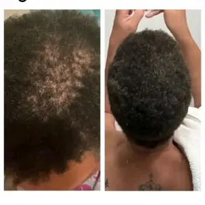 Haircare Oil Conditioner Rosemary Shampoo Tea Tree Comfort Cleansing Cleanser with Growth Oil