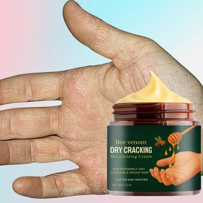 Bee Venom Moisturizing Cream for Dry Cracked Feet and Hands, Deep Hydration Softens Light Skin, Smooth and Soft