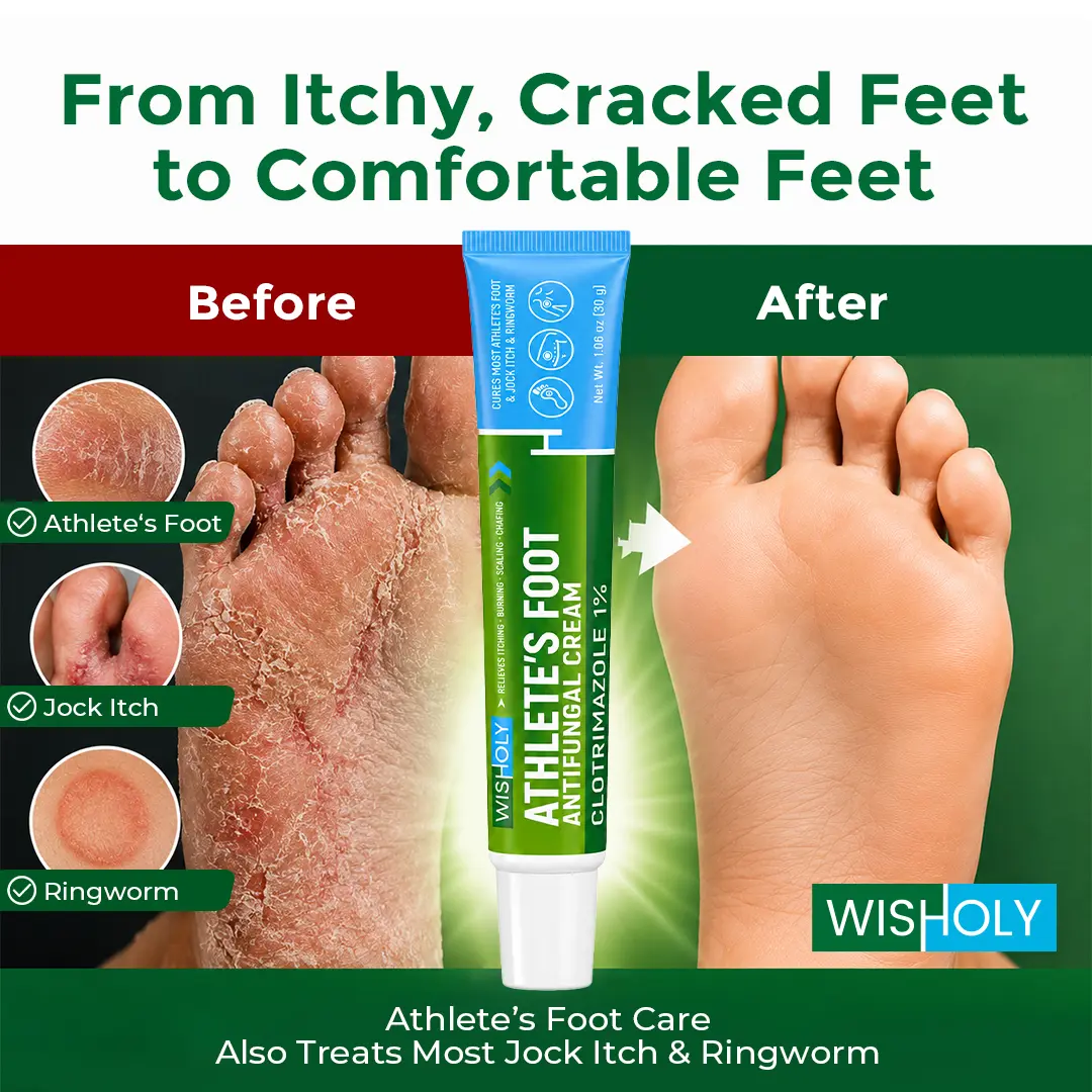 Wisholy Foot Itch Cream, Relieves Itching, Burning, Cracking & Scaling, Cures Most Athlete’s Foot, Jock Itch & Ringworm, Clotrimazole 1%, 1.06 oz