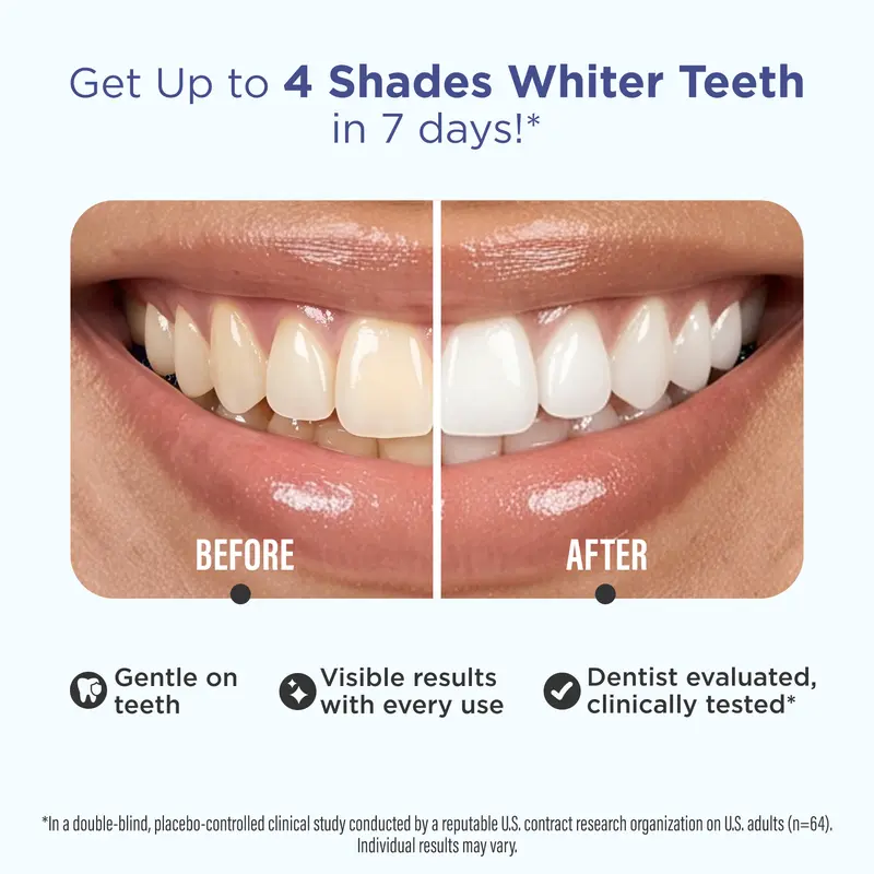 Whitening Strips Product Image