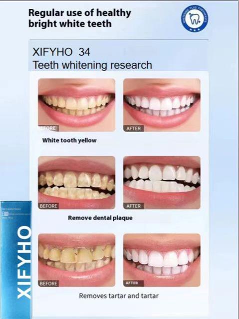 XIFYHO Whitening Toothpaste for Instant StainRemoval | Colour Corrector for TeethBrightening l Fresh Breath Formula, ColourCorrecting